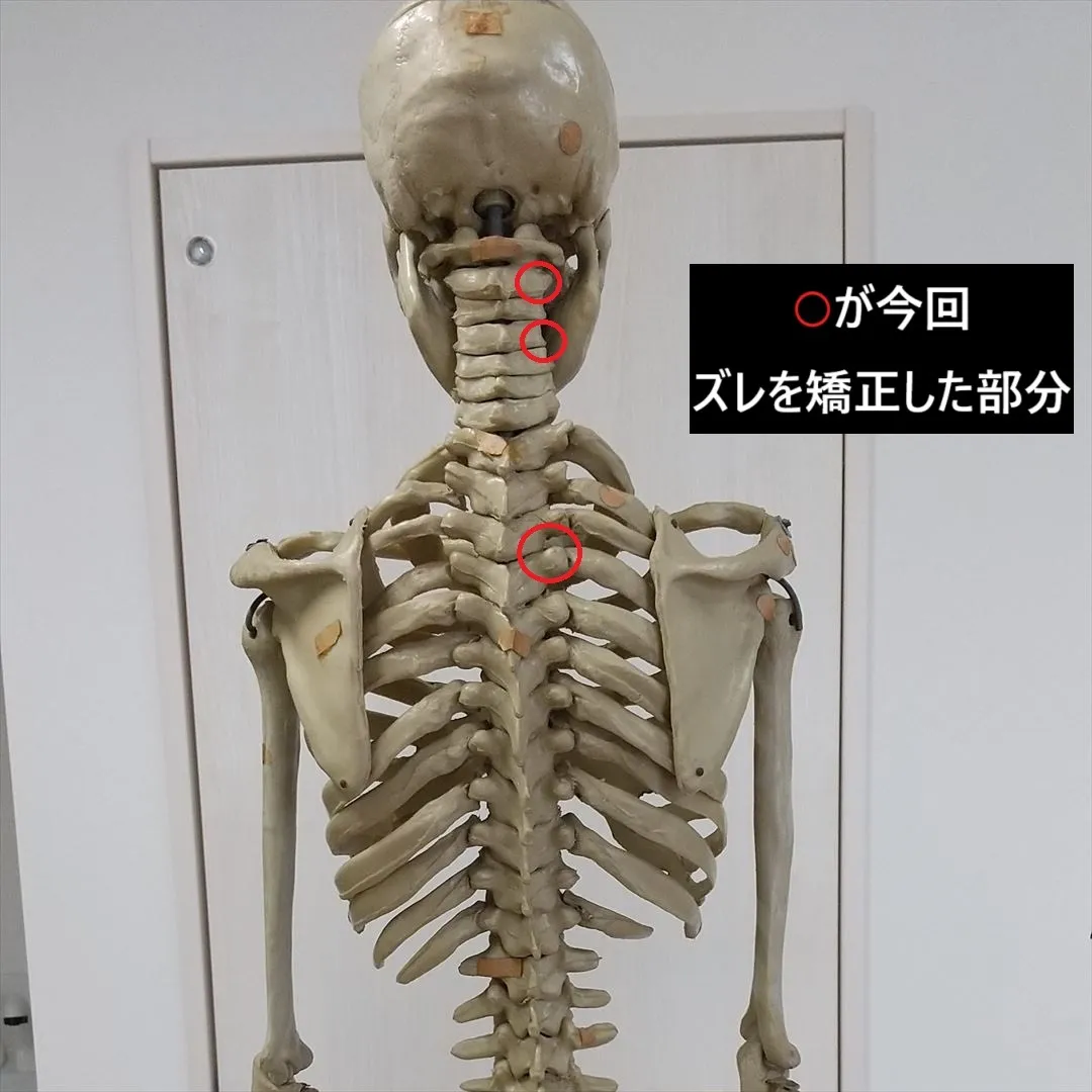 【腕を挙げると痛い原因は？】