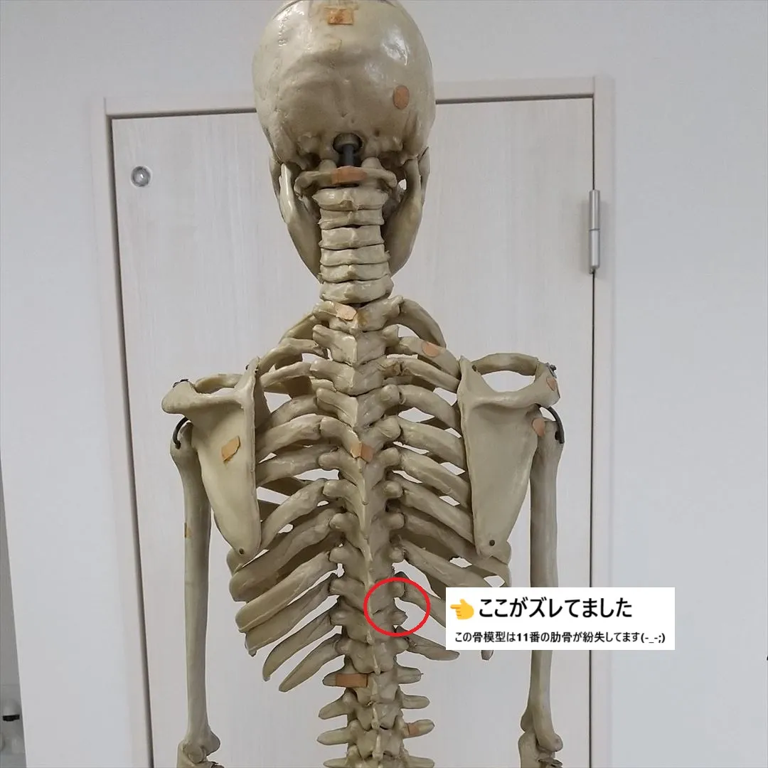 【ぎっくり背中】
