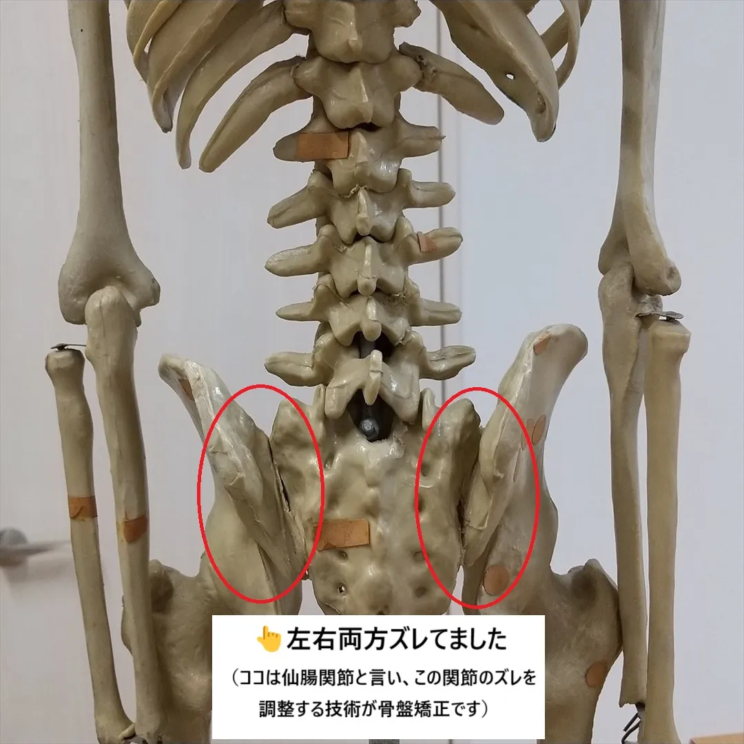 【腰とお尻の痛み】