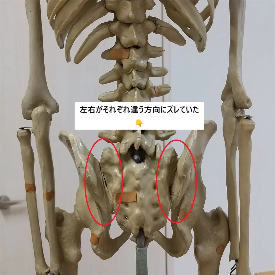 【慢性的な腰痛の施術】