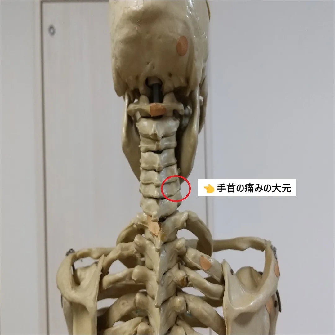 【手首の痛み】