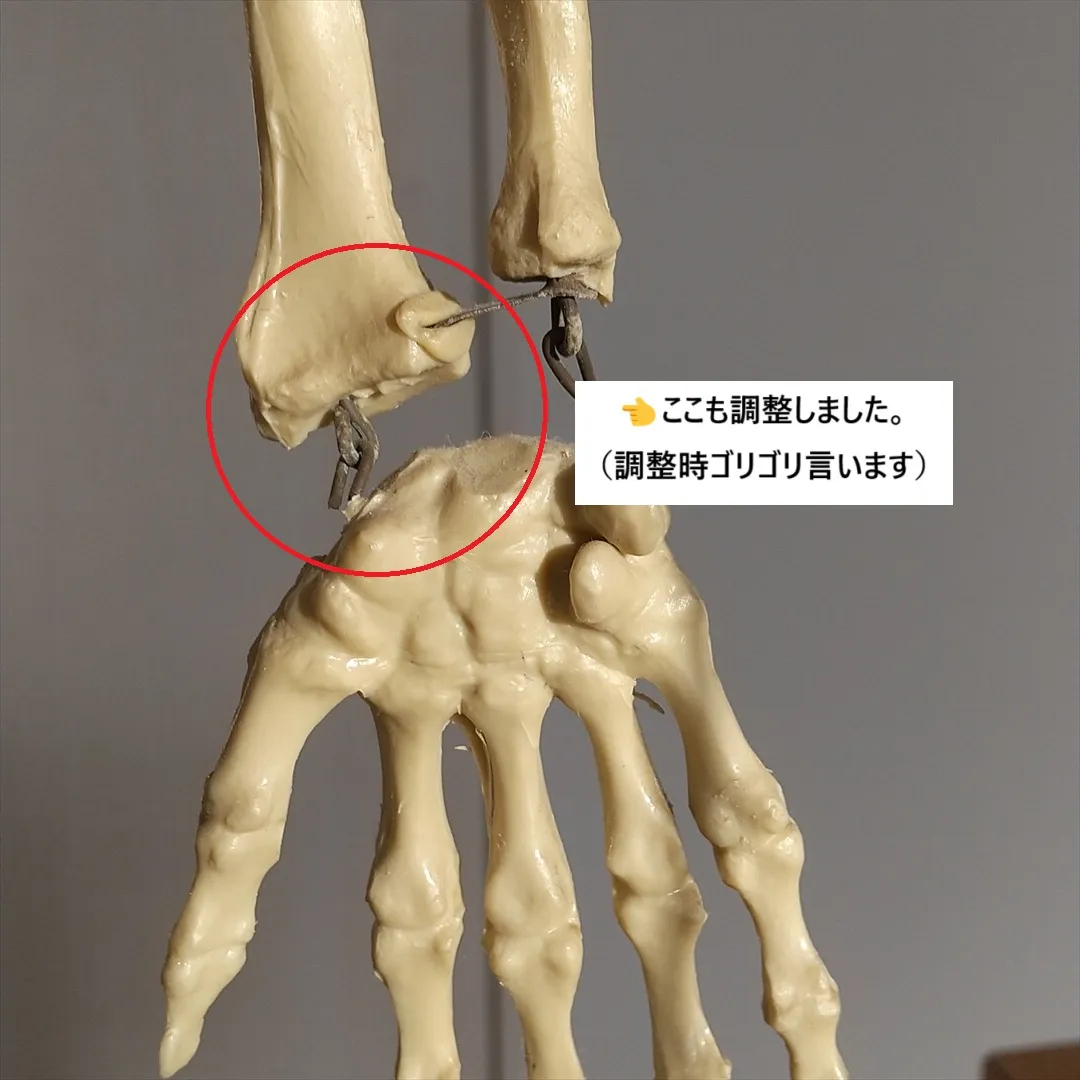 【手首の痛み】