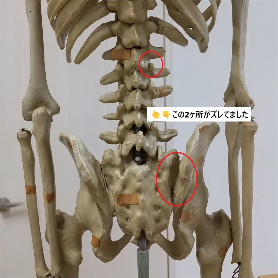 【背中と腰の中間の痛み】